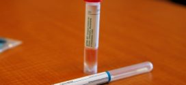 Coronavirus: Laboratories struggling to meet the demand for tests
