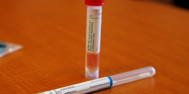 Coronavirus: Laboratories struggling to meet the demand for tests