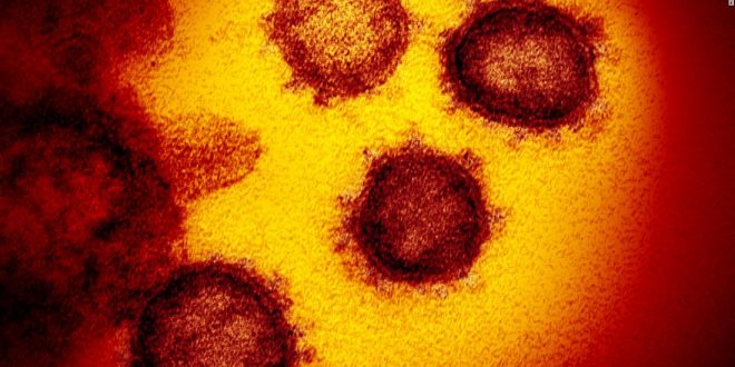 US coronavirus update: Latest news on cases, deaths and reopenings