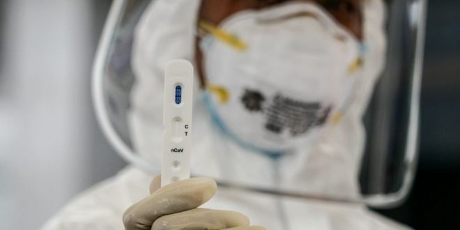 Pretoria firm to roll out 5 000 Covid-19 test kits a day to plug shortage | News24