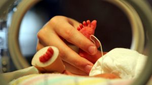 Far fewer premature babies during COVID-19